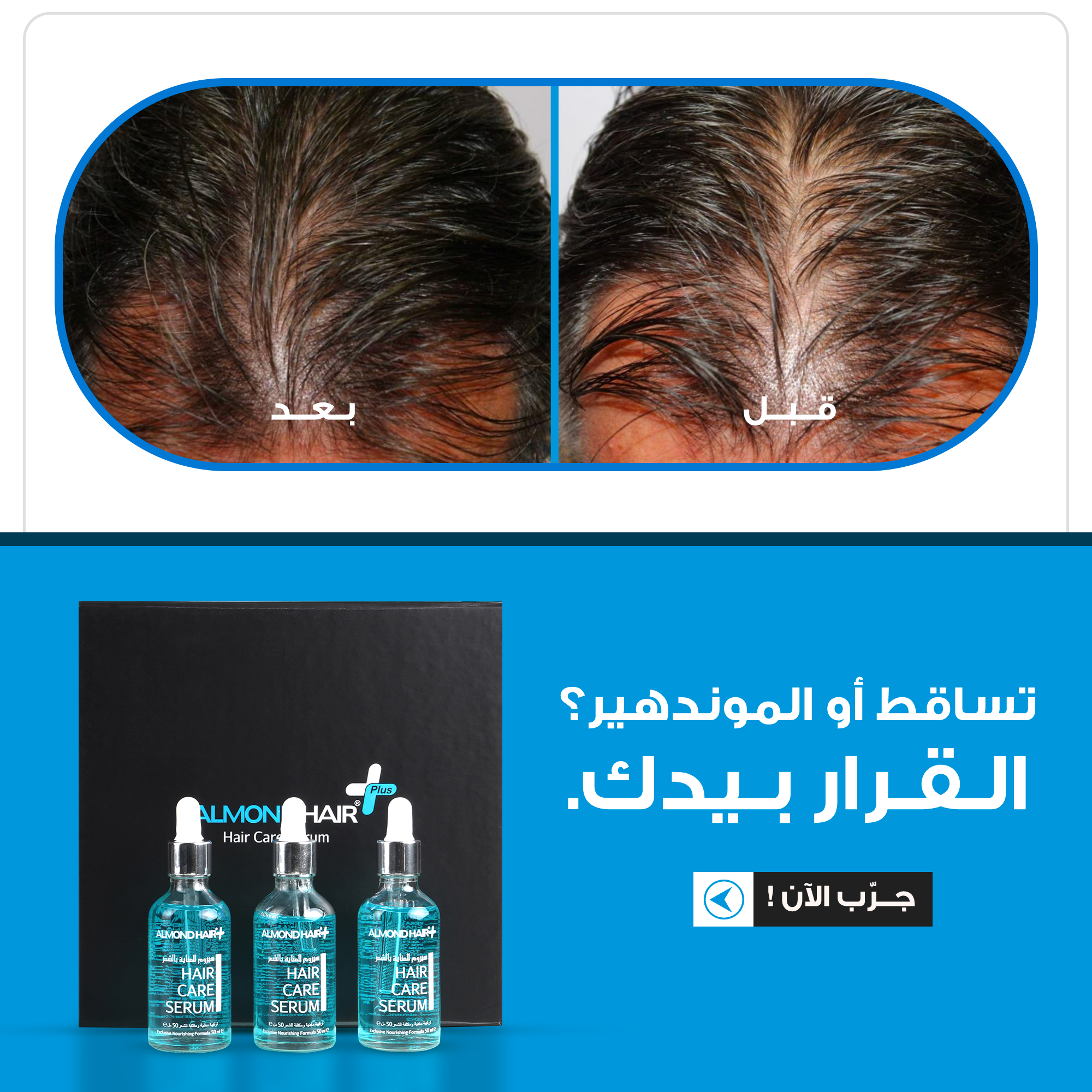 Almond Hair Natural Hair Protection Oil 15 in 1