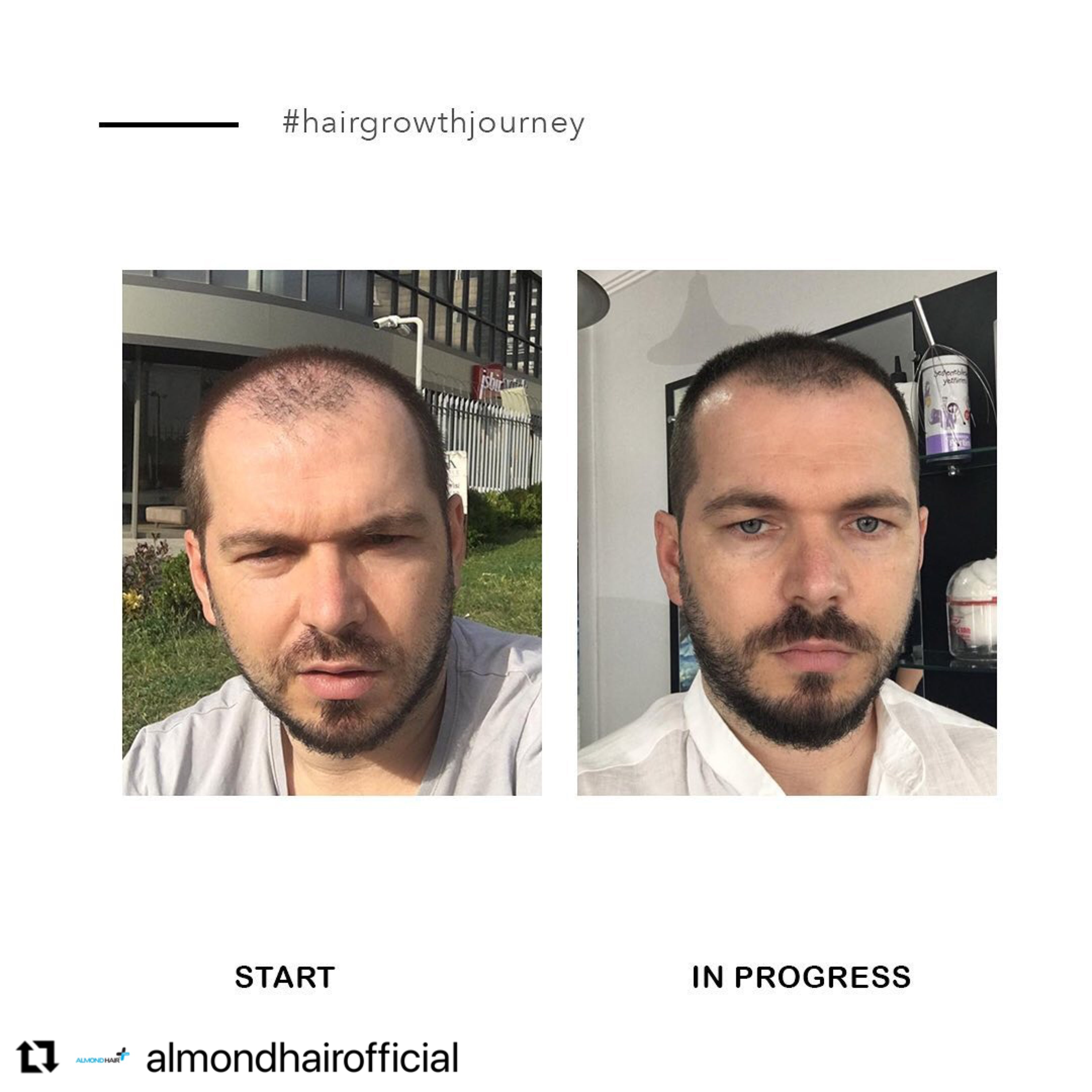 Hair Growth Serum – Botanical Peptide Complex