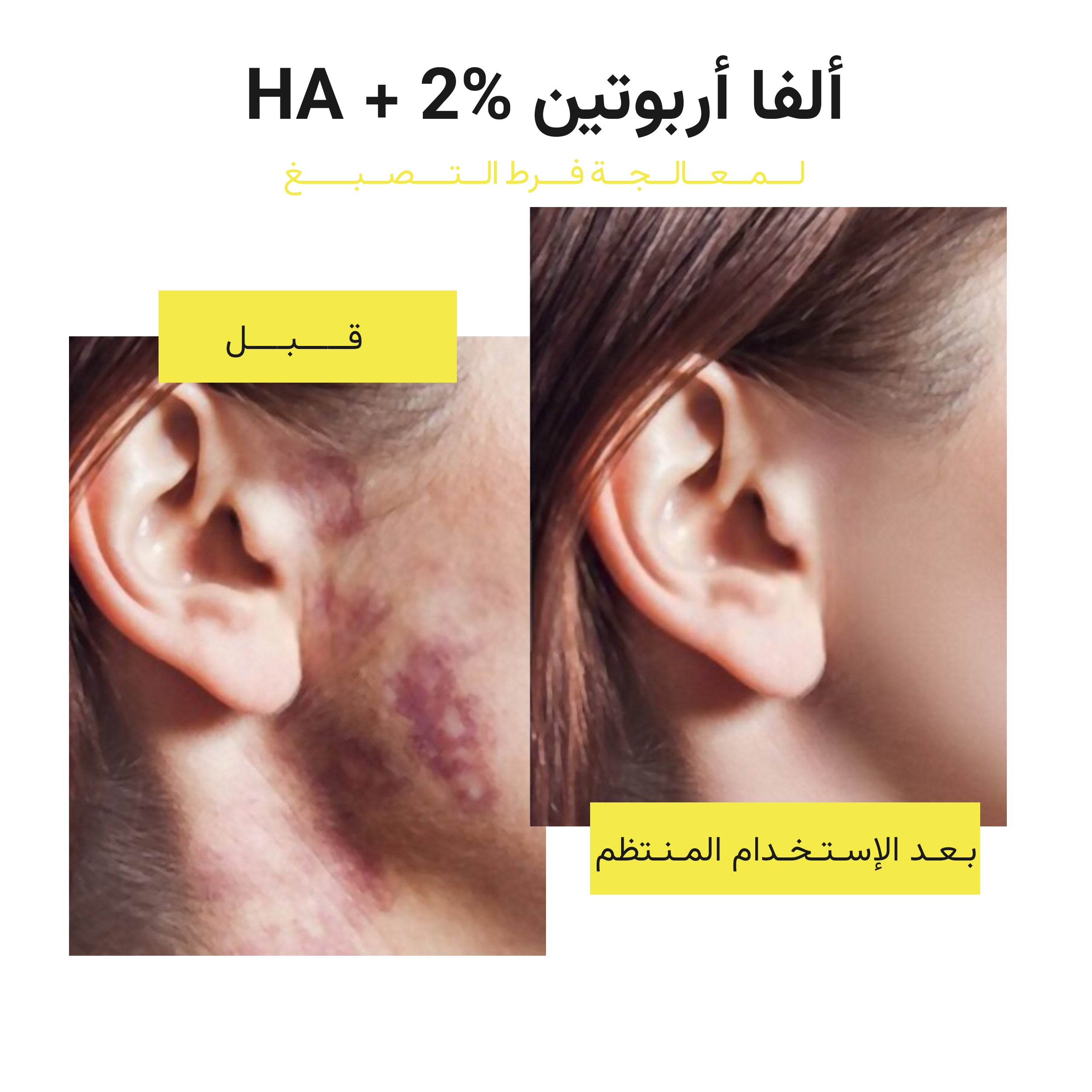 The Almond Beauty EvenTone Alpha 2% Serum