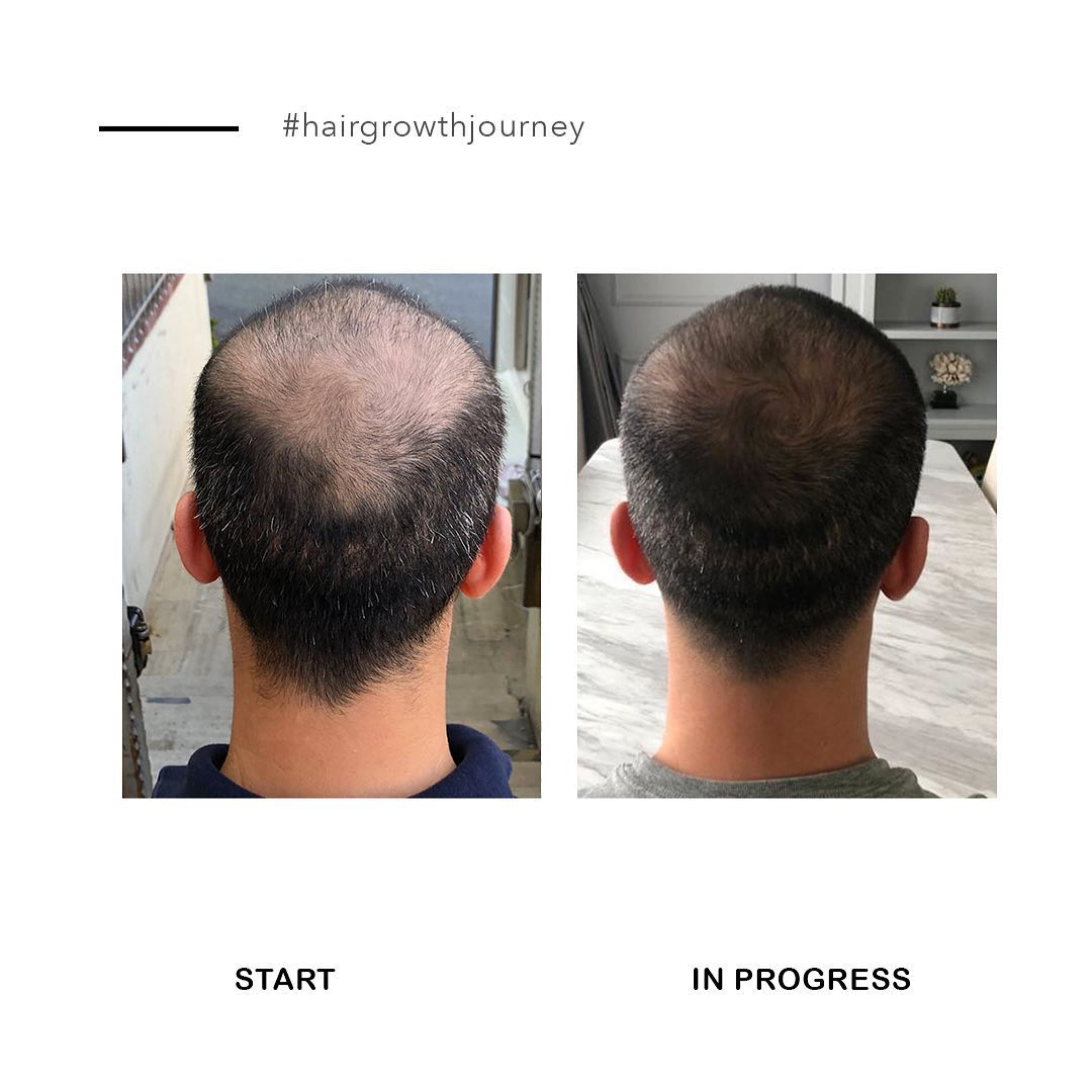 Men’s Growth Kit – Peptide Complex